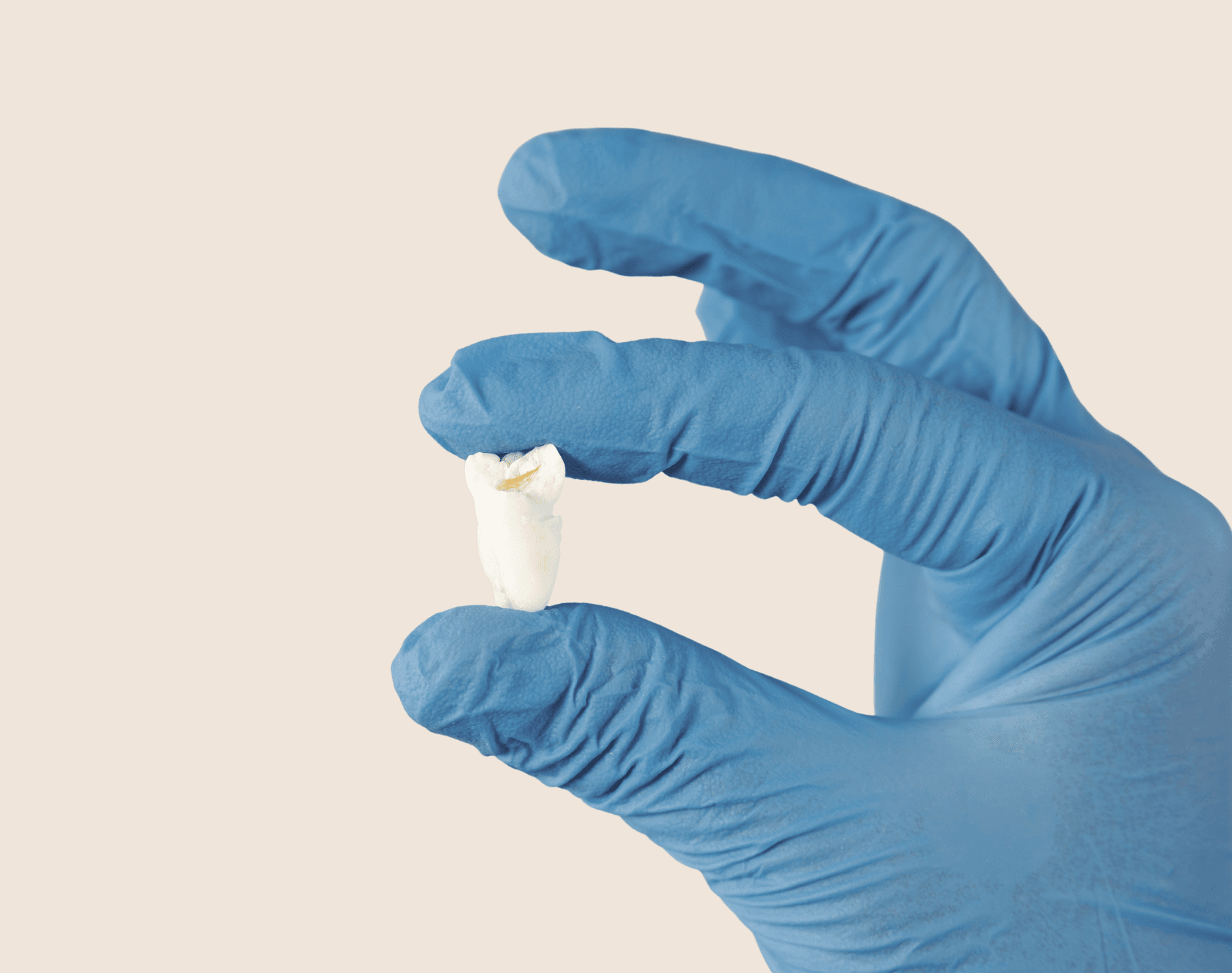Wisdom Tooth Pain 1