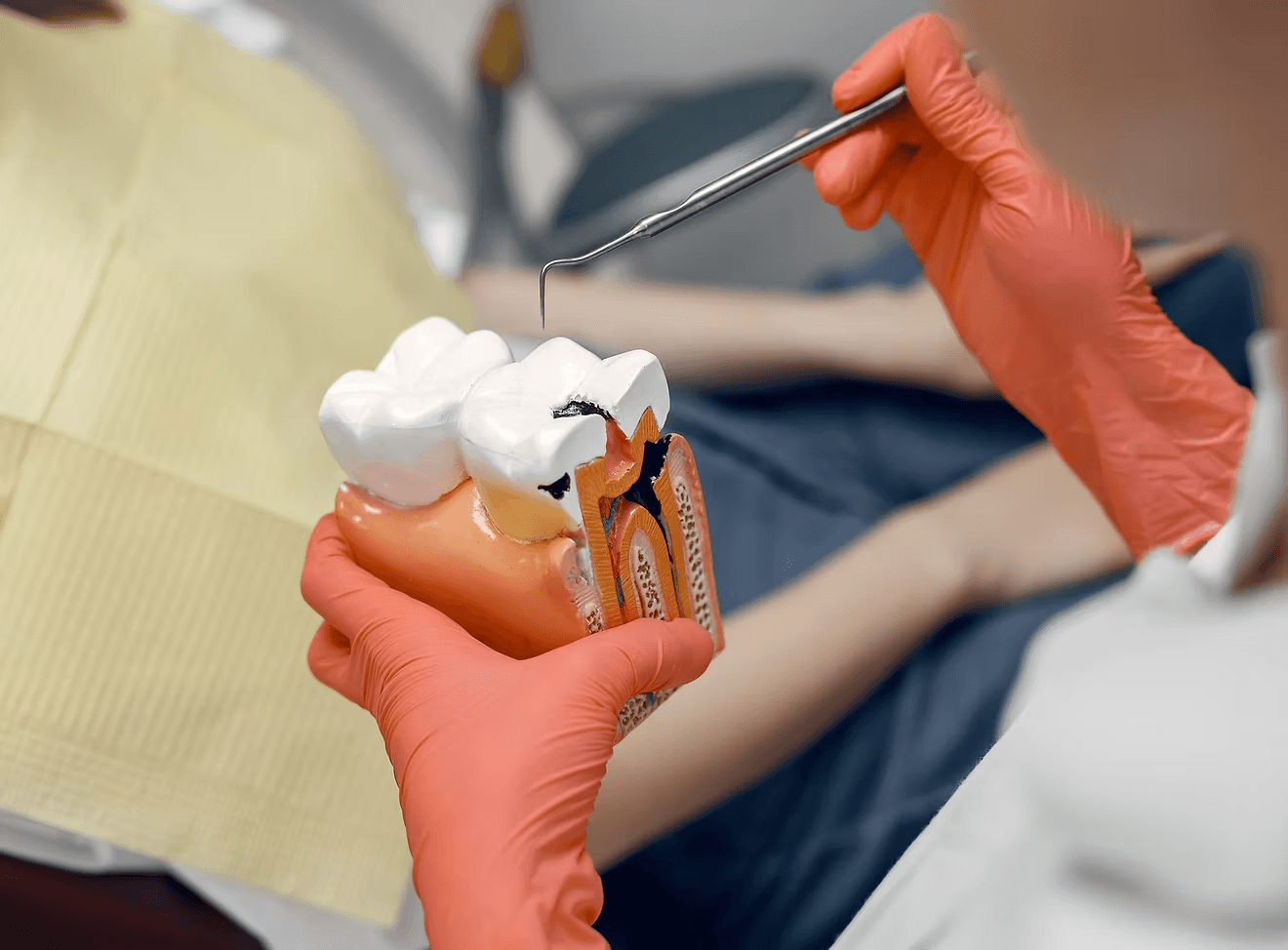 Root Canal Treatment