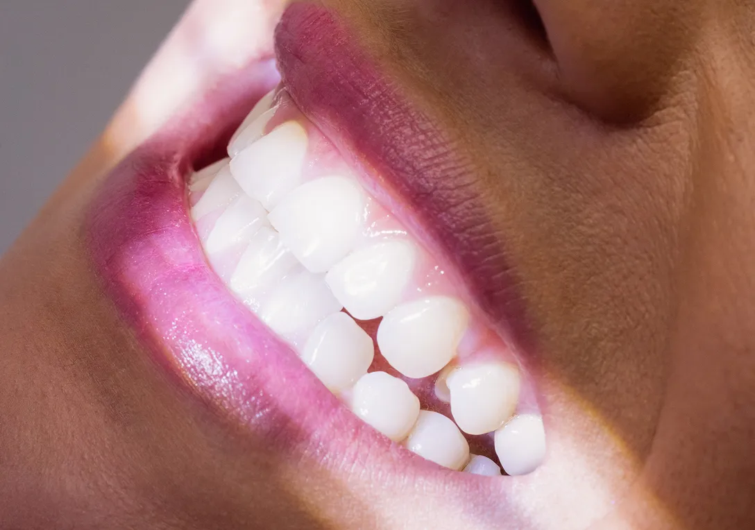 Close-up of a smiling person with white teeth and dark pink lipstick.